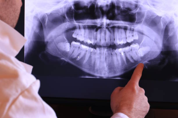 Best Broken or Cracked Tooth Emergency Dentist in Cienegas Terrace, TX